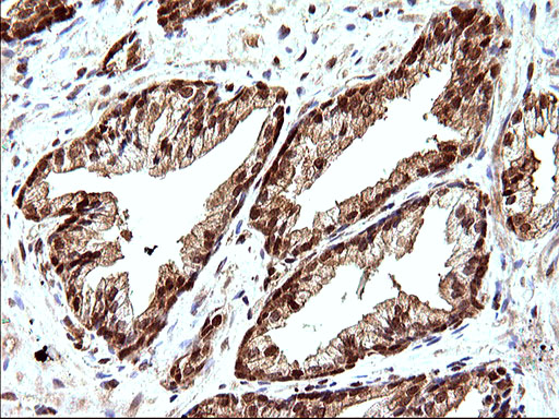 LZIC Antibody - IHC of paraffin-embedded Human prostate tissue using anti-LZIC mouse monoclonal antibody. (Heat-induced epitope retrieval by 10mM citric buffer, pH6.0, 120°C for 3min).