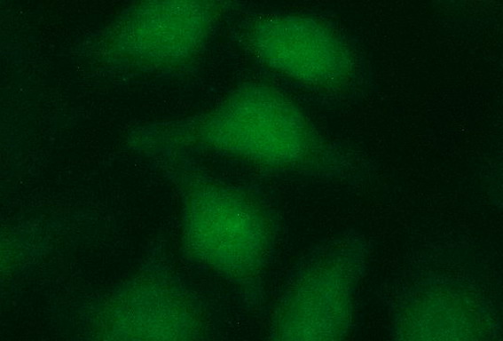 LZIC Antibody - Immunofluorescent staining of HeLa cells using anti-LZIC mouse monoclonal antibody.