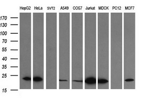 LZIC Antibody - Western blot of extracts (35ug) from 9 different cell lines by using anti-LZIC monoclonal antibody (HepG2: human; HeLa: human; SVT2: mouse; A549: human; COS7: monkey; Jurkat: human; MDCK: canine; PC12: rat; MCF7: human).