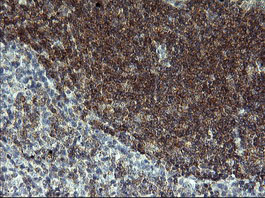 LZIC Antibody - IHC of paraffin-embedded Human lymph node tissue using anti-LZIC mouse monoclonal antibody. (Heat-induced epitope retrieval by 10mM citric buffer, pH6.0, 120°C for 3min).