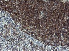 LZIC Antibody - IHC of paraffin-embedded Human lymph node tissue using anti-LZIC mouse monoclonal antibody. (Heat-induced epitope retrieval by 10mM citric buffer, pH6.0, 120°C for 3min).