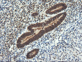 LZIC Antibody - IHC of paraffin-embedded Human endometrium tissue using anti-LZIC mouse monoclonal antibody.