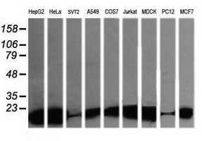 LZIC Antibody - Western blot of extracts (35 ug) from 9 different cell lines by using g anti-LZIC monoclonal antibody (HepG2: human; HeLa: human; SVT2: mouse; A549: human; COS7: monkey; Jurkat: human; MDCK: canine; PC12: rat; MCF7: human).
