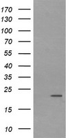 LZIC Antibody - HEK293T cells were transfected with the pCMV6-ENTRY control (Left lane) or pCMV6-ENTRY LZIC (Right lane) cDNA for 48 hrs and lysed. Equivalent amounts of cell lysates (5 ug per lane) were separated by SDS-PAGE and immunoblotted with anti-LZIC.
