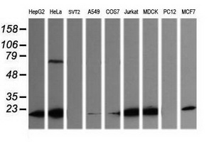 LZIC Antibody - Western blot of extracts (35ug) from 9 different cell lines by using anti-LZIC monoclonal antibody (HepG2: human; HeLa: human; SVT2: mouse; A549: human; COS7: monkey; Jurkat: human; MDCK: canine; PC12: rat; MCF7: human).