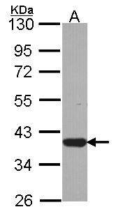 LZTFL1 Antibody - Sample (30 ug of whole cell lysate). A: JurKat. 10% SDS PAGE. LZTFL1 antibody diluted at 1:1000.