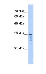 LZTFL1 Antibody - Jurkat cell lysate. Antibody concentration: 2.5 ug/ml. Gel concentration: 12%.  This image was taken for the unconjugated form of this product. Other forms have not been tested.