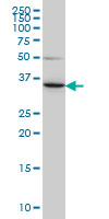 LZTFL1 Antibody - LZTFL1 monoclonal antibody (M01), clone 7F6 Western blot of LZTFL1 expression in HeLa.