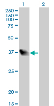 LZTFL1 Antibody - Western blot of LZTFL1 expression in transfected 293T cell line by LZTFL1 monoclonal antibody (M01), clone 7F6.