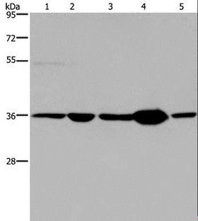 LZTFL1 Antibody - Western blot analysis of Human transitional cell carcinoma tissue, 293T and A172 cell, human testis tissue and HeLa cell, using LZTFL1 Polyclonal Antibody at dilution of 1:550.