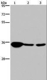 LZTFL1 Antibody - Western blot analysis of Human testis tissue, 293T and A 172 cell, using LZTFL1 Polyclonal Antibody at dilution of 1:300.