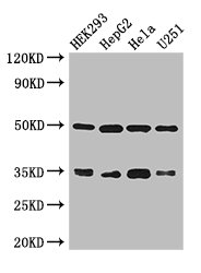 LZTFL1 Antibody - Positive WB detected in:HEK293 whole cell lysate,HepG2 whole cell lysate,Hela whole cell lysate,U251 whole cell lysate;All lanes: LZTFL1 antibody at 3ug/ml;Secondary;Goat polyclonal to rabbit IgG at 1/50000 dilution;Predicted band size: 35,33,30 kDa;Observed band size: 35,50 kDa;