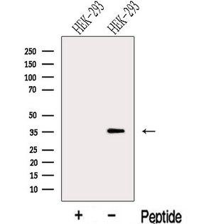 LZTFL1 Antibody - Western blot analysis of extracts of HEK293 cells using LZTFL1 antibody. The lane on the left was treated with blocking peptide.