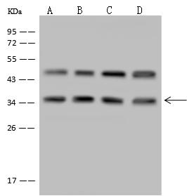 LZTFL1 Antibody - Anti-LZTFL1 rabbit polyclonal antibody at 1:500 dilution. Lane A: Jurkat Whole Cell Lysate. Lane B: HepG2 Whole Cell Lysate. Lane C: HeLa Whole Cell Lysate. Lane D: U-251 MG Whole Cell Lysate. Lysates/proteins at 30 ug per lane. Secondary: Goat Anti-Rabbit IgG (H+L)/HRP at 1/10000 dilution. Developed using the ECL technique. Performed under reducing conditions. Predicted band size: 35 kDa. Observed band size: 35 kDa. (We are unsure as to the identity of these extra bands.)