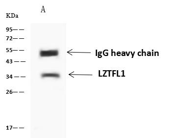 LZTFL1 Antibody - LZTFL1 was immunoprecipitated using: Lane A: 0.5 mg Jurkat Whole Cell Lysate. 4 uL anti-LZTFL1 rabbit polyclonal antibody and 60 ug of Immunomagnetic beads Protein A/G. Primary antibody: Anti-LZTFL1 rabbit polyclonal antibody, at 1:100 dilution. Secondary antibody: Goat Anti-Rabbit IgG (H+L)/HRP at 1/10000 dilution. Developed using the ECL technique. Performed under reducing conditions. Predicted band size: 35 kDa. Observed band size: 34 kDa.