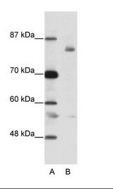 LZTR1 Antibody - A: Marker, B: Jurkat Cell Lysate.  This image was taken for the unconjugated form of this product. Other forms have not been tested.