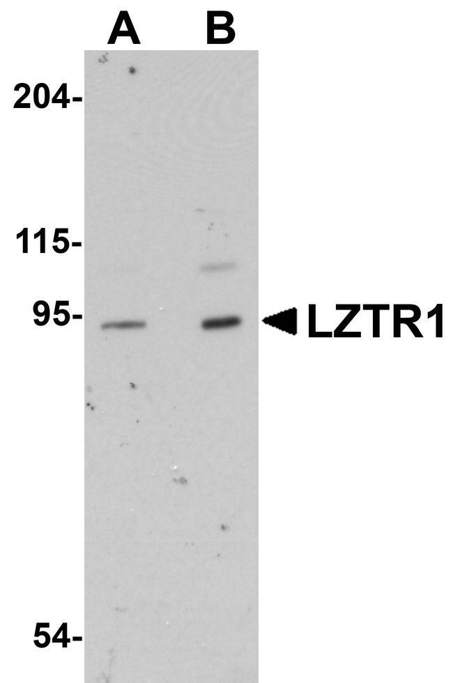 LZTR1 Antibody - Western blot analysis of LZTR1 in human heart tissue lysate with LZTR1 antibody at (A) 1 and (B) 2 ug/ml.