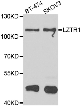 LZTR1 Antibody - Western blot analysis of extracts of various cell lines.