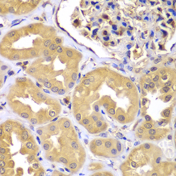 LZTR1 Antibody - Immunohistochemistry of paraffin-embedded human kidney tissue.