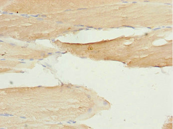 LZTR1 Antibody - Immunohistochemistry of paraffin-embedded human skeletal muscle tissue tissue at dilution 1:100