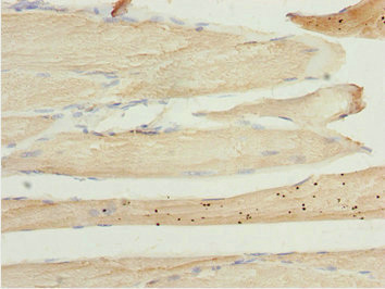 LZTR1 Antibody - Immunohistochemistry of paraffin-embedded human skeletal muscle tissue tissue at dilution 1:100