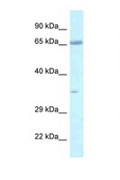 LZTS1 Antibody - LZTS1 antibody Western blot of Mouse Thymus lysate. Antibody concentration 1 ug/ml.  This image was taken for the unconjugated form of this product. Other forms have not been tested.