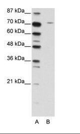 LZTS1 Antibody - A: Marker, B: Jurkat Cell Lysate.  This image was taken for the unconjugated form of this product. Other forms have not been tested.