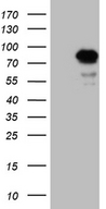 LZTS1 Antibody - HEK293T cells were transfected with the pCMV6-ENTRY control. (Left lane) or pCMV6-ENTRY LZTS1. (Right lane) cDNA for 48 hrs and lysed. Equivalent amounts of cell lysates. (5 ug per lane) were separated by SDS-PAGE and immunoblotted with anti-LZTS1. (1:2000)