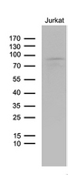 LZTS1 Antibody - Western blot analysis of extracts. (35ug) from Jurkat cell lines by using anti-LZTS1 monoclonal antibody. (1:500)