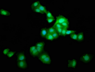 LZTS1 Antibody - Immunofluorescence staining of HepG2 cells at a dilution of 1:166, counter-stained with DAPI. The cells were fixed in 4% formaldehyde, permeabilized using 0.2% Triton X-100 and blocked in 10% normal Goat Serum. The cells were then incubated with the antibody overnight at 4 °C.The secondary antibody was Alexa Fluor 488-congugated AffiniPure Goat Anti-Rabbit IgG (H+L) .