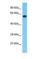 LZTS1 Antibody - Western blot of LZTS1 Antibody with 293T Whole Cell lysate.  This image was taken for the unconjugated form of this product. Other forms have not been tested.