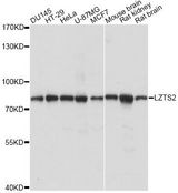 LZTS2 Antibody - Western blot analysis of extracts of various cell lines, using LZTS2 antibody at 1:1000 dilution. The secondary antibody used was an HRP Goat Anti-Rabbit IgG (H+L) at 1:10000 dilution. Lysates were loaded 25ug per lane and 3% nonfat dry milk in TBST was used for blocking. An ECL Kit was used for detection and the exposure time was 5s.