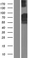 LZTS2 Protein - Western validation with an anti-DDK antibody * L: Control HEK293 lysate R: Over-expression lysate