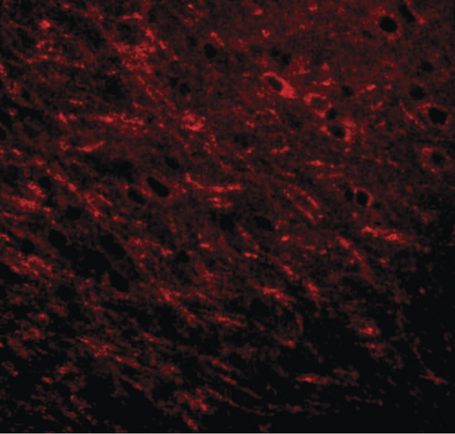 LZTS3 Antibody - Immunofluorescence of Prosapip 1 in rat brain tissue with Prosapip 1 antibody at 20 ug/ml.