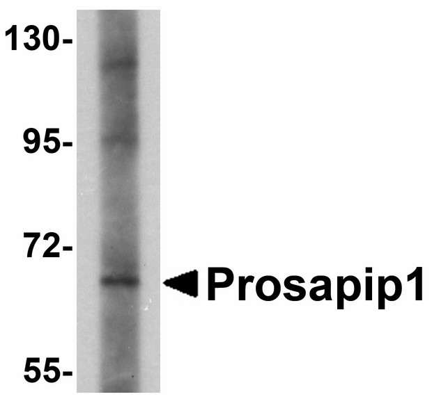 LZTS3 Antibody - Western blot of Prosapip1 in SK-N-SH cell lysate with Prosapip1 antibody at 1 ug/ml. Below: Immunohistochemistry of Prosapip1 in rat brain tissue with Prosapip1 antibody at 2.5 ug/ml.