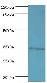 M-PST / STM Antibody - Western blot. All lanes: Sulfotransferase 1A3 antibody at 7 ug/ml+A549 whole cell lysate. Secondary antibody: Goat polyclonal to rabbit at 1:10000 dilution. Predicted band size: 34 kDa. Observed band size: 34 kDa Immunohistochemistry.
