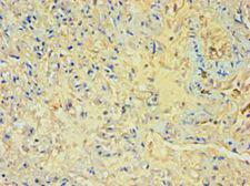 M-PST / STM Antibody - Immunohistochemistry of paraffin-embedded human lung tissue using antibody at 1:100 dilution.