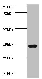 M-PST / STM Antibody - Western blot All lanes: Sulfotransferase 1A3 antibody at 7µg/ml + A549 whole cell lysate Secondary Goat polyclonal to rabbit IgG at 1/10000 dilution Predicted band size: 35, 23 kDa Observed band size: 35 kDa