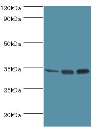 M-PST / STM Antibody - Western blot. All lanes: Sulfotransferase 1A3 antibody at 10 ug/ml. Lane 1: A549 whole cell lysate. Lane 2: mouse liver tissue. Lane 2: mouse kidney tissue. secondary Goat polyclonal to rabbit at 1:10000 dilution. Predicted band size: 34 kDa. Observed band size: 34 kDa.