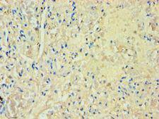 M-PST / STM Antibody - Immunohistochemistry of paraffin-embedded human lung tissue using antibody at 1:100 dilution.