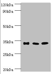 M-PST / STM Antibody - Western blot All lanes: Sulfotransferase 1A3 antibody at 10µg/ml Lane 1: A549 whole cell lysate Lane 2: Mouse liver tissue Lane 2: Mouse kidney tissue Secondary Goat polyclonal to rabbit IgG at 1/10000 dilution Predicted band size: 35, 23 kDa Observed band size: 35 kDa