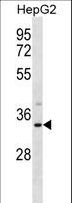 M-PST / STM Antibody - SULT1A3 Antibody western blot of HepG2 cell line lysates (35 ug/lane). The SULT1A3 antibody detected the SULT1A3 protein (arrow).