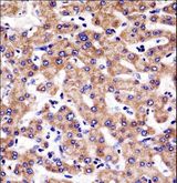 M-PST / STM Antibody - SULT1A3 Antibody immunohistochemistry of formalin-fixed and paraffin-embedded human liver tissue followed by peroxidase-conjugated secondary antibody and DAB staining.