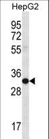M-PST / STM Antibody - SULT1A3/SULT1A4 Antibody western blot of HepG2 cell line lysates (35 ug/lane). The SULT1A3/SULT1A4 antibody detected the SULT1A3/SULT1A4 protein (arrow).