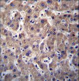 M-PST / STM Antibody - SULT1A3/SULT1A4 Antibody immunohistochemistry of formalin-fixed and paraffin-embedded human liver tissue followed by peroxidase-conjugated secondary antibody and DAB staining.This data demonstrates the use of SULT1A3/SULT1A4 Antibody for immunohistochemistry.