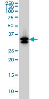 M-PST / STM Antibody - SULT1A3 monoclonal antibody (M01), clone 1B10 Western Blot analysis of SULT1A3 expression in HepG2.