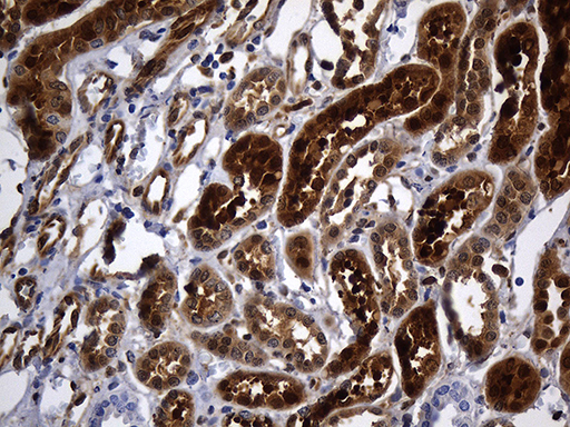 M-PST / STM Antibody - Immunohistochemical staining of paraffin-embedded Human Kidney tissue within the normal limits using anti-SULT1A3 mouse monoclonal antibody. (Heat-induced epitope retrieval by 1mM EDTA in 10mM Tris buffer. (pH8.5) at 120°C for 3 min. (1:500)