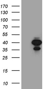M-PST / STM Antibody - HEK293T cells were transfected with the pCMV6-ENTRY control. (Left lane) or pCMV6-ENTRY SULT1A3. (Right lane) cDNA for 48 hrs and lysed