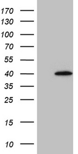M-PST / STM Antibody - HEK293T cells were transfected with the pCMV6-ENTRY control. (Left lane) or pCMV6-ENTRY SULT1A3. (Right lane) cDNA for 48 hrs and lysed. Equivalent amounts of cell lysates. (5 ug per lane) were separated by SDS-PAGE and immunoblotted with anti-SULT1A3. (1:2000)