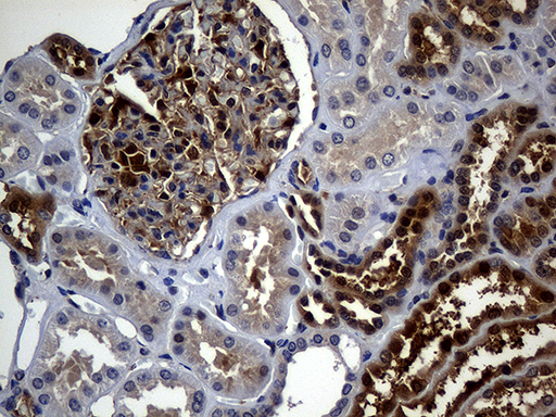 M-PST / STM Antibody - Immunohistochemical staining of paraffin-embedded Human Kidney tissue within the normal limits using anti-SULT1A3 mouse monoclonal antibody. (Heat-induced epitope retrieval by 1mM EDTA in 10mM Tris buffer. (pH8.5) at 120°C for 3 min. (1:150)